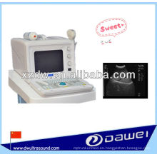 Escáner Ultrasound portátil de tipo B portátil para la venta